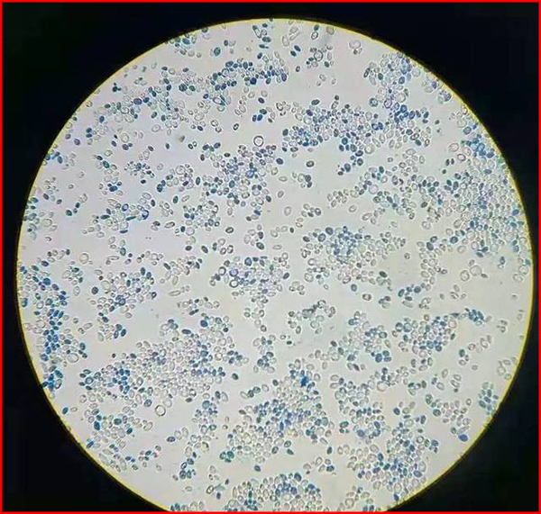 显微镜下的细菌